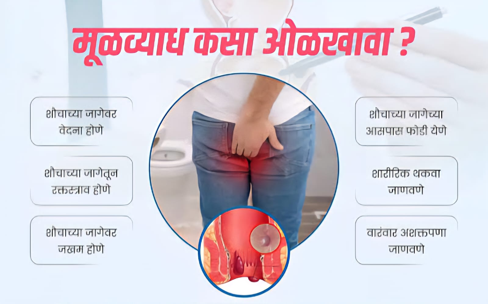 Piles Treatment (मुळव्याध उपचार) — Ayuraa Healthcare